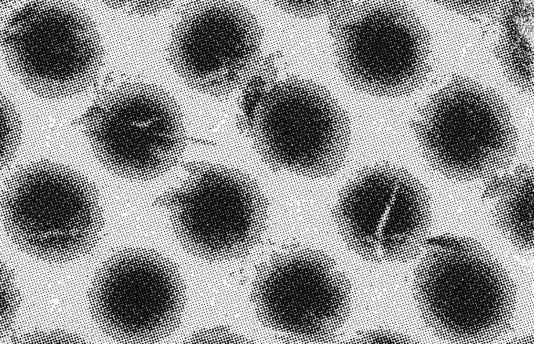 Razor burn – soothe and avoid those painful polka dots